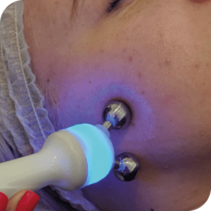 Electro Ion
Jowl & Eye Brow Lifting