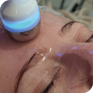 Hydration
Product Infusion & Targeting Dehydrated Skin