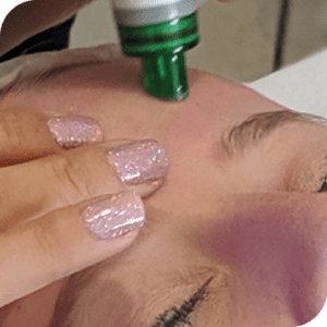 Hydro Peel
Deep Cleanse Targeting Congestion